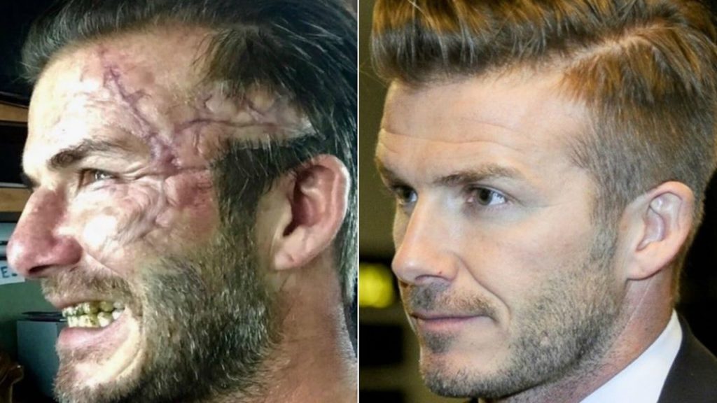 gigi kuning David Beckham dalam king arthur